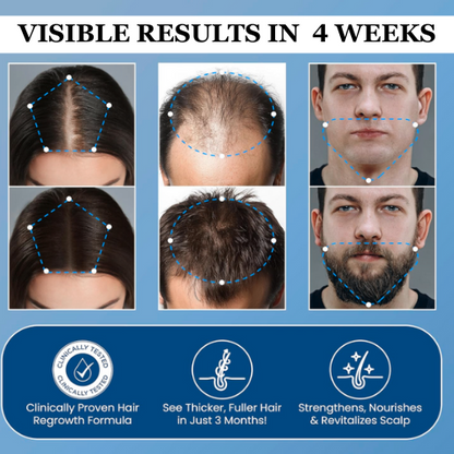 Ascend Hair Growth Roll-on Serum