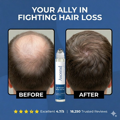 Ascend Hair Growth Roll-on Serum