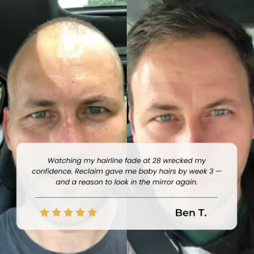 Ascend Hair Growth Roll-on Serum