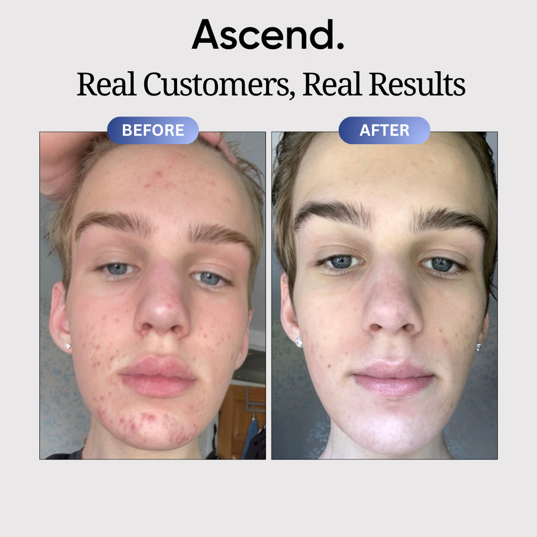 Copper Peptide Skin Serum™