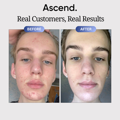 Copper Peptide Skin Serum™