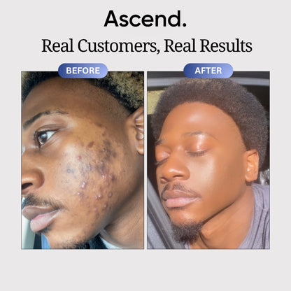 Copper Peptide Skin Serum™